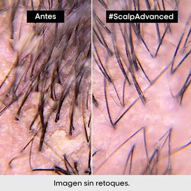 L'Oréal Professionnel Serie Expert Scalp Advanced Pelliculaire Schampo Lugnande torr och fet hårbotten Anti-mjällschampo 300 ml 300 ml