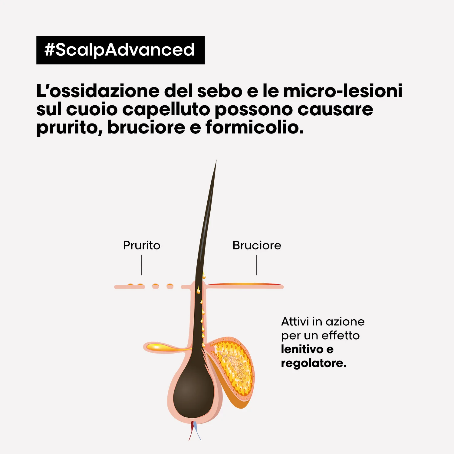 SERIE EXPERT New Scalp Advanced Trattamento Intense Soother Anti-Discomfort - Balsamo Purificante Capelli