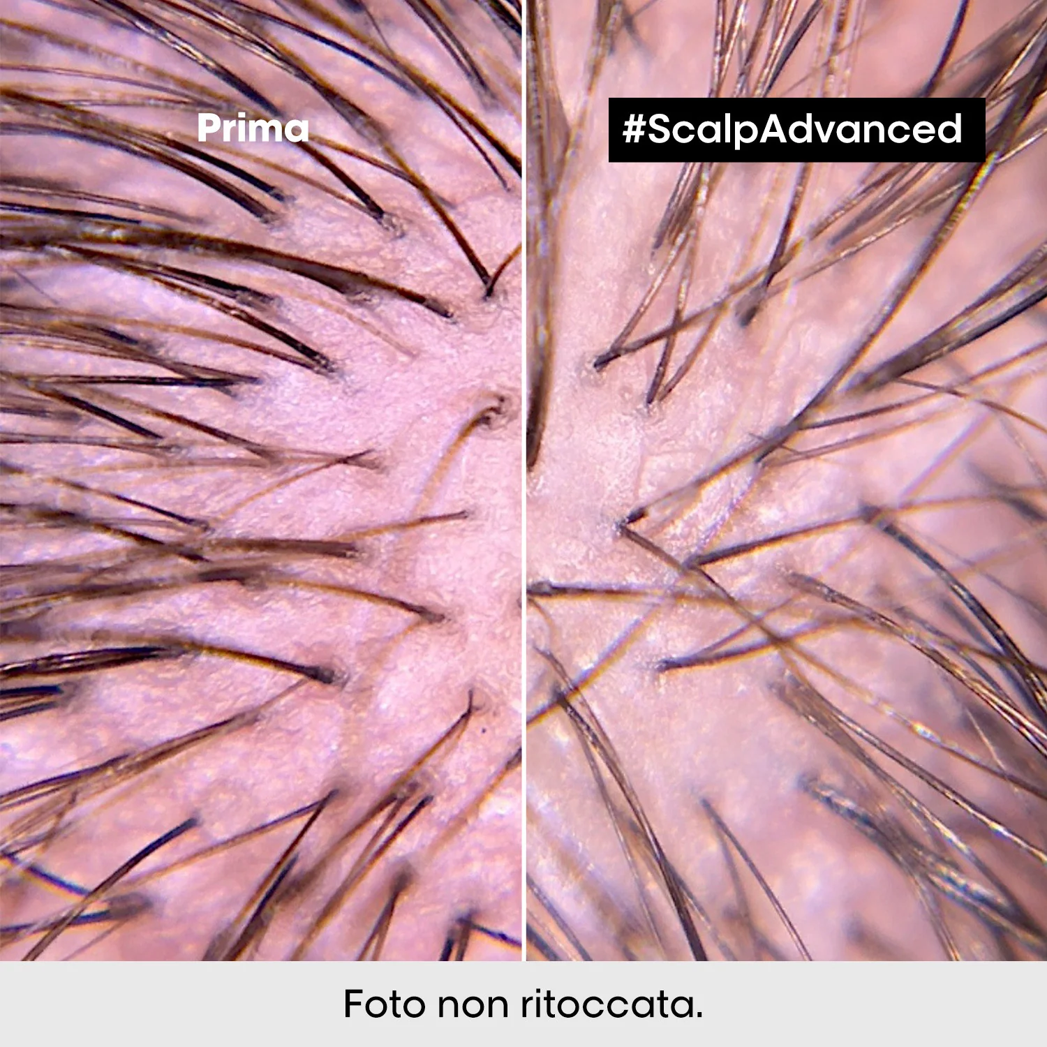 SERIE EXPERT New Scalp Advanced Trattamento Intense Soother Anti-Discomfort - Balsamo Purificante Capelli
