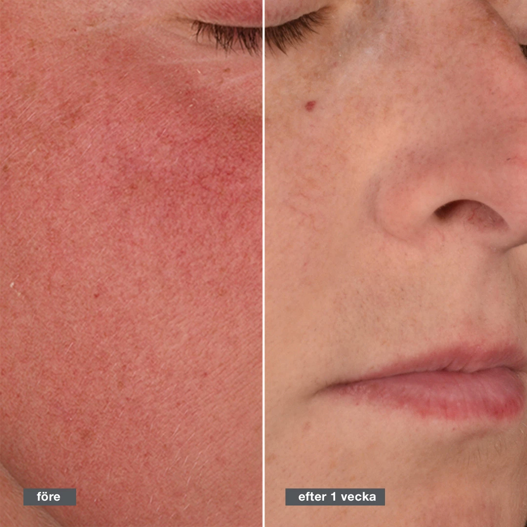 Stabilizační regenerační krém 50 ml - Dermalogica