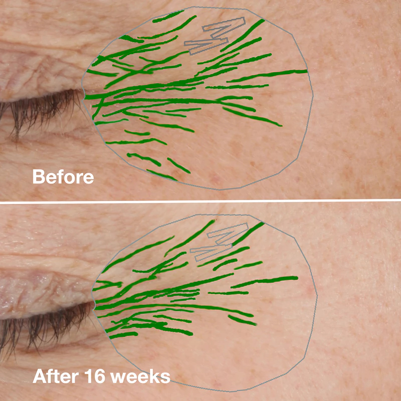 Sérum Corretor de Rugas Clinique Smart Clinical™ Repair