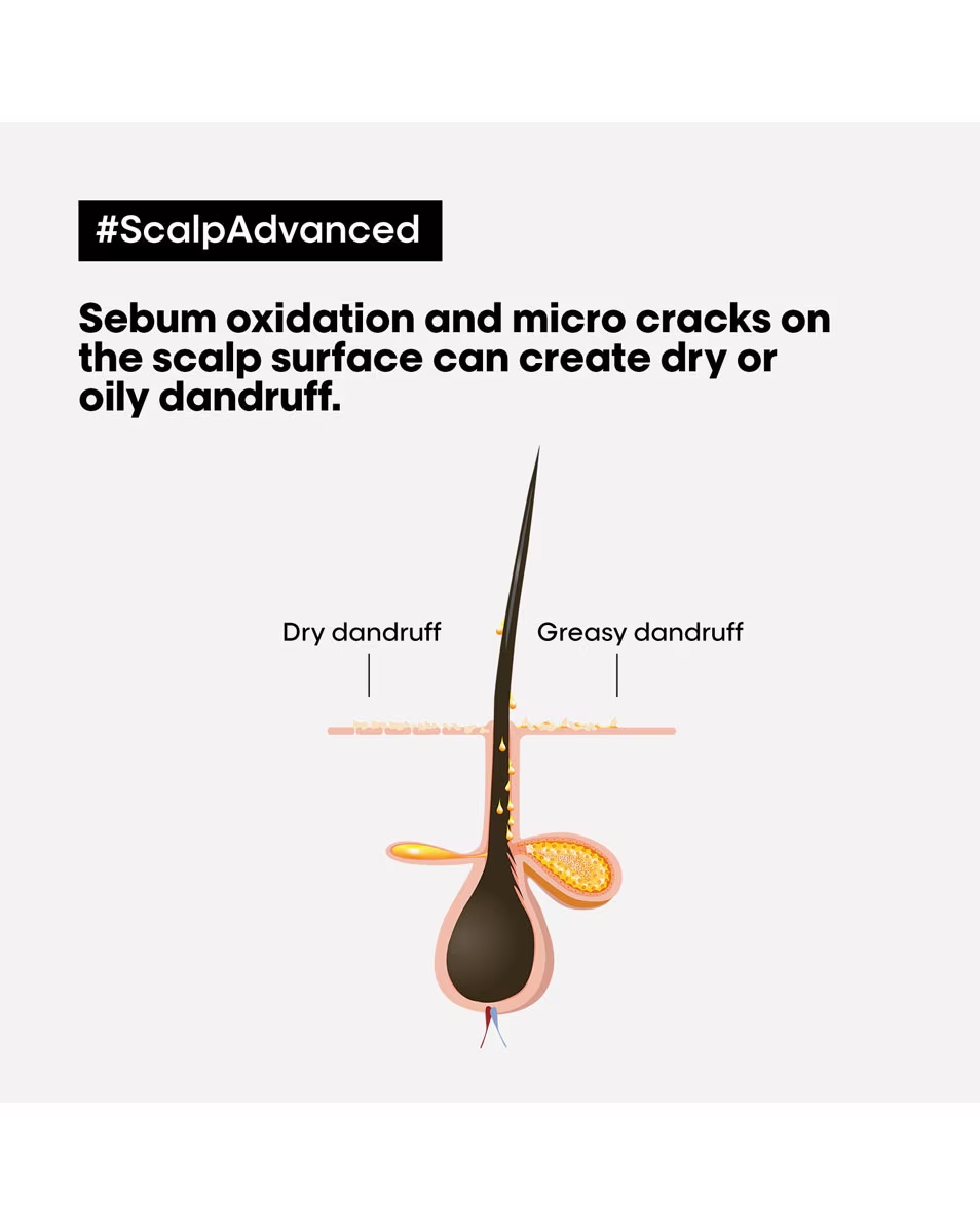 L'ORÉAL PROFESSIONNEL Scalp Advanced Șampon dermo-clarificant anti-mătreață