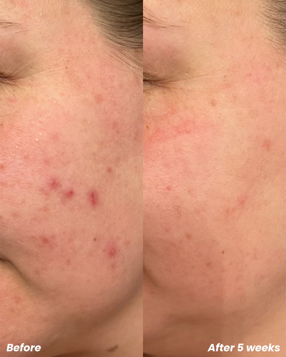 Exfoliant CLAY AND GLOW Exfoliant BHA/AHA