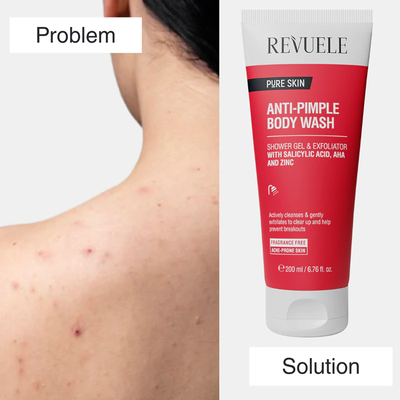 Revuele Pure Skin Gel de Banho Esfoliante Anti-Acne