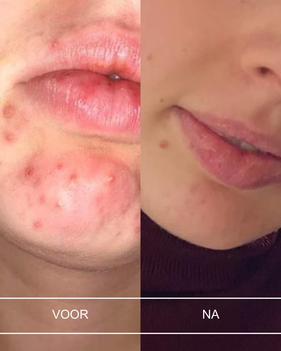 Lapte demachiant facial SELF delicat, purificator - Față și ochi