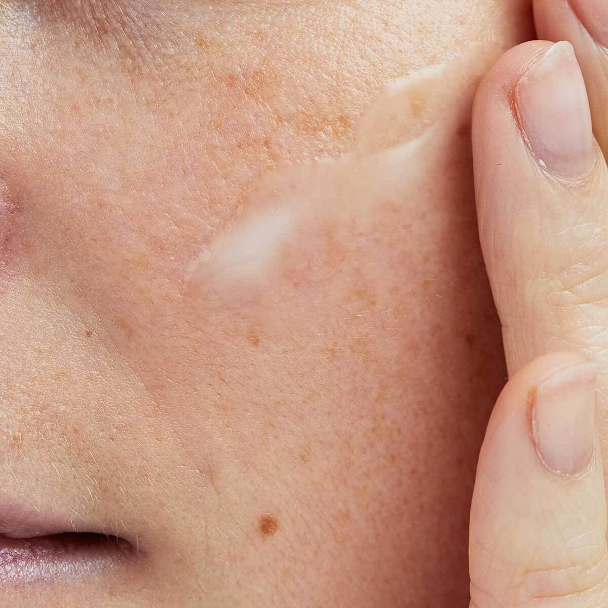 Pai Skincare hialurono rūgšties serumas „Grįžimas į gyvenimą“ – 30 ml