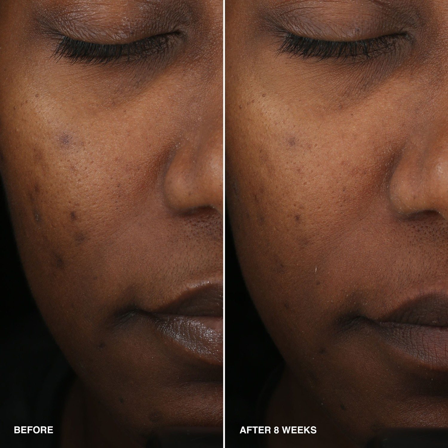Bobbi Brown drėkinamasis serumas, vitaminais praturtintas lyginamasis serumas – 30 ml