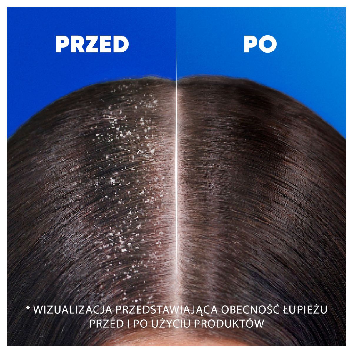 Head&Shoulders Βαθιά Ενυδάτωση