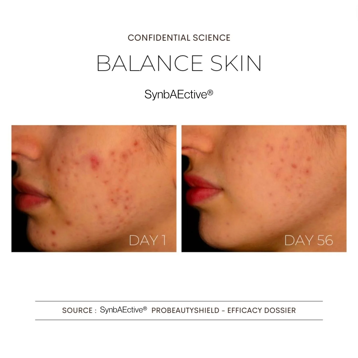 Integratori Balance Skin - Integratore Pelle, Integratore Viso