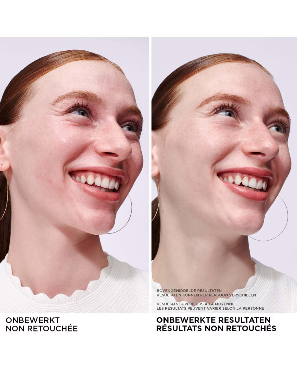 IT KOSMETIKA BYE BYE SERUM BYE BYE REDNESS SERUM