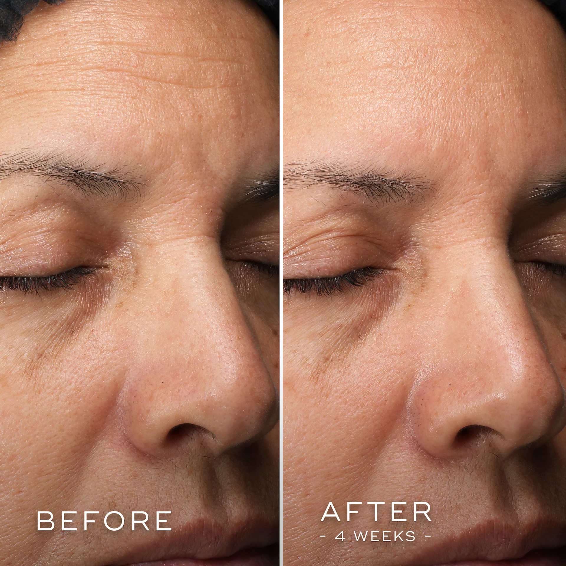 C-Tetra Luxe 30 ml - Medik8