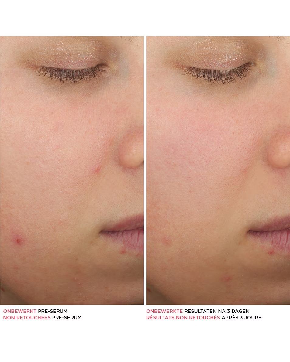 IT KOSMETIKA BYE BYE SERUM BYE BYE BREAKOUT SERUM