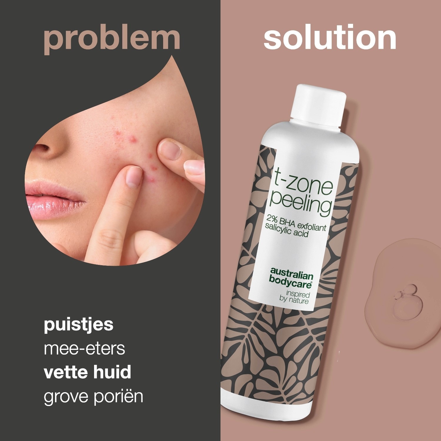 Пилинг за лице Australian Bodycare Пилинг за Т-зону - 150 мл