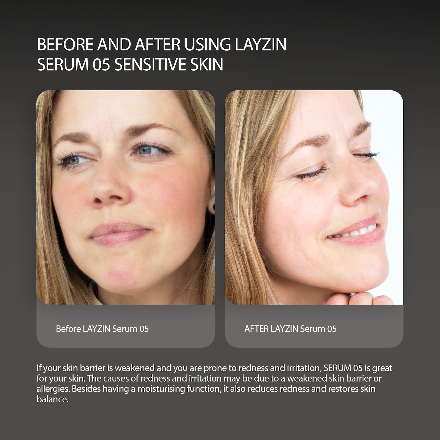 LAYZIN Serum protiv starenja SERUM 05 – Umirujući serum za osjetljivu i nadraženu kožu – 30 ml