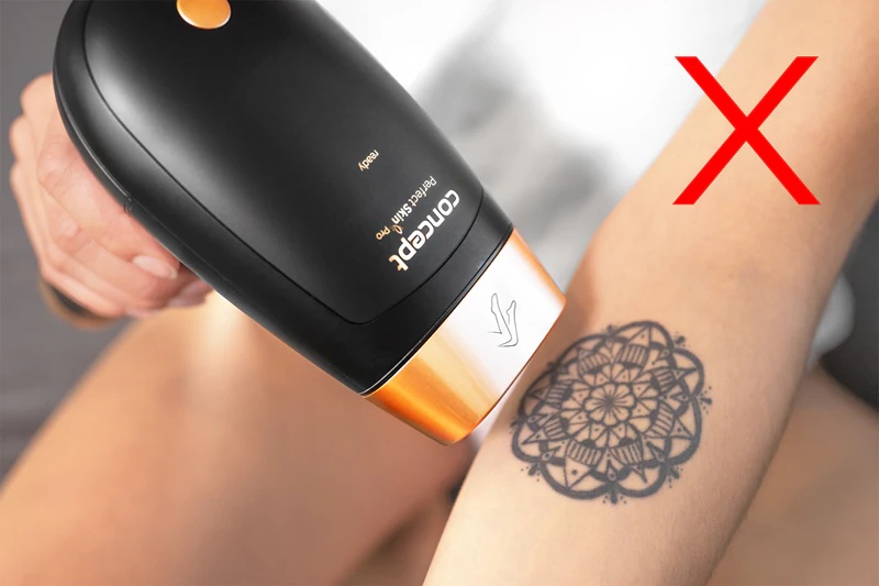Concept Perfect Skin Pro Anti-Age IL5020 IPL epilator za telo, obraz, bikini predel in pazduhe