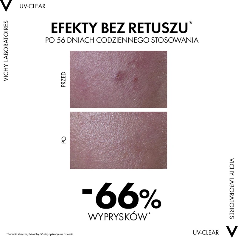 Vichy Capital Soleil UV-Clear третман против бора за масну кожу склону акнама