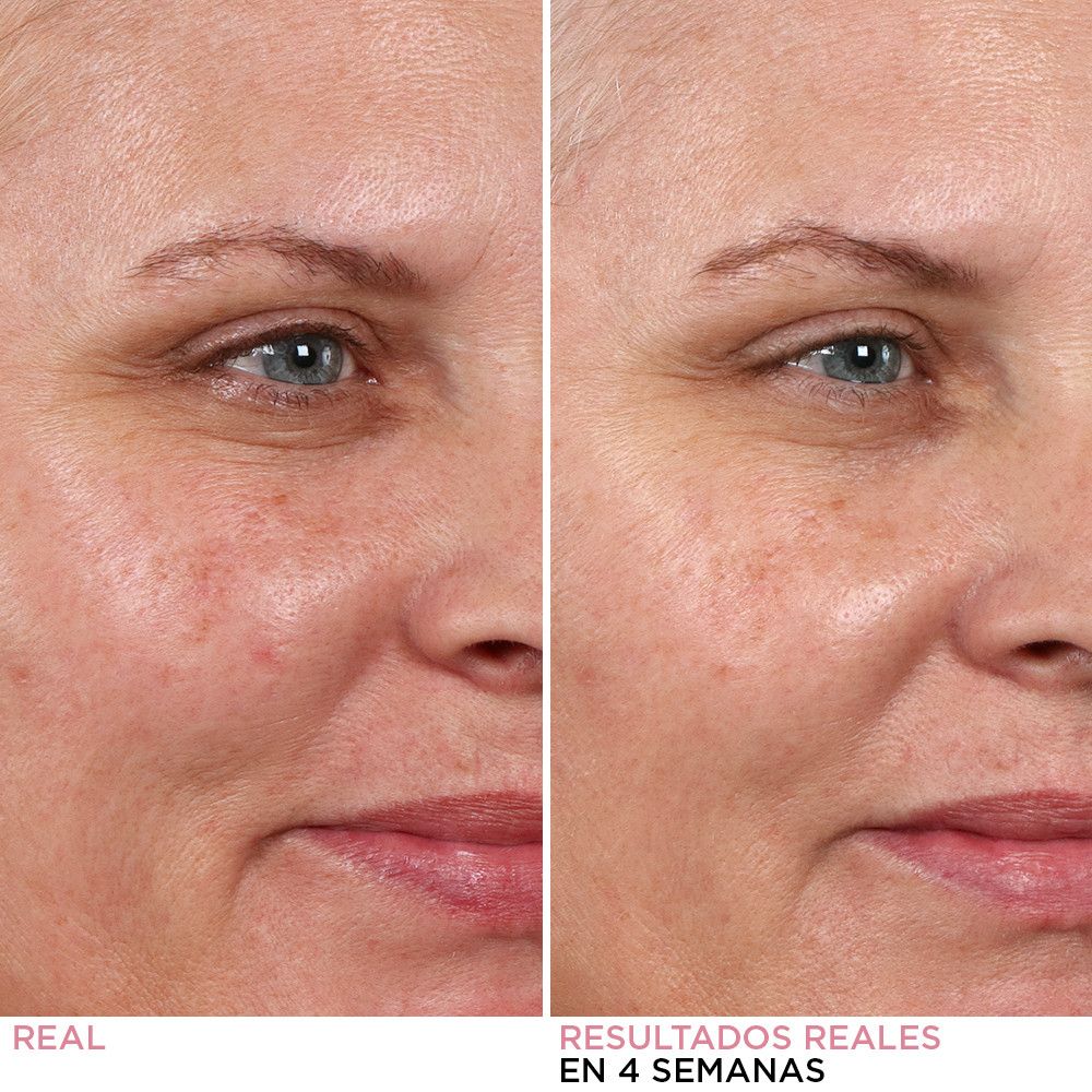 „Hello Results Baby Night Peel“ Prabangūs drėkikliai ir maitinamosios priemonės