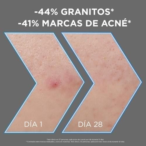 Garnier Pure Active serum proti nepravilnostim z niacinamidom Serumi