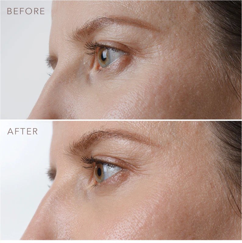 Sérum firmador para olhos FOREO IRIS™