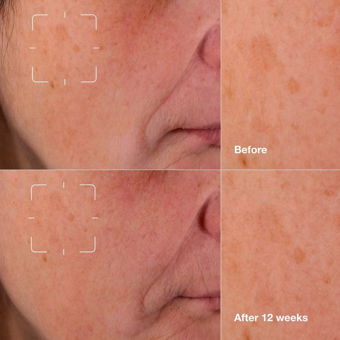 Clinique Vitamin C Serum Even Better™ – Клинички ефикасан серум против тамних мрља – 30 мл