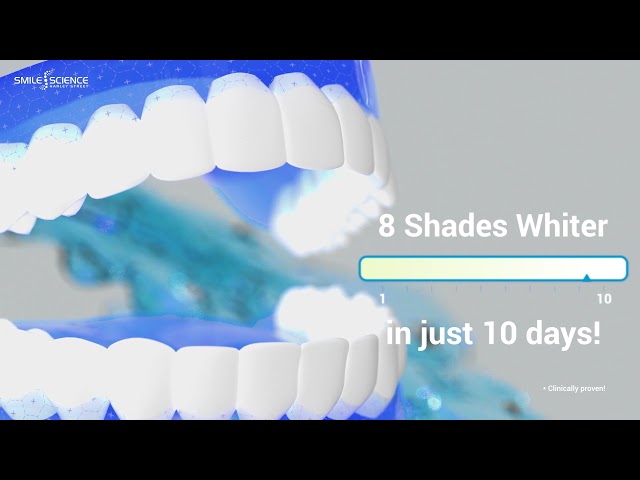 Benzi de albire a dinților Smile Science Harley Street