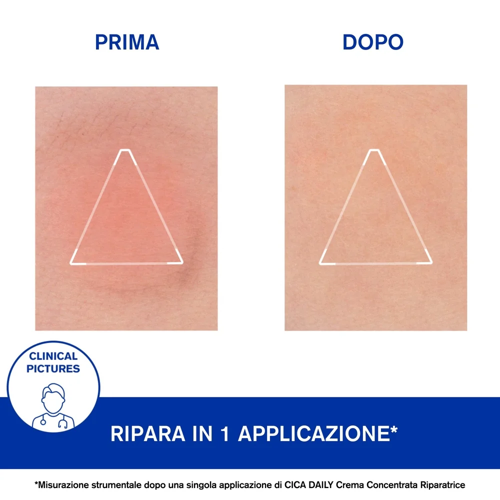 CICA DAILY Crema Concentrata Riparatrice - Trattamento Riparatore, Tratt.viso 24 ore idratante