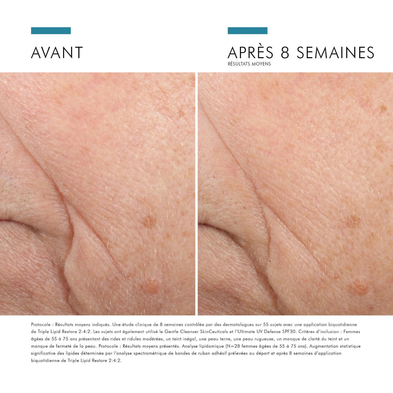 SkinCeuticals Triple Lipid Restore