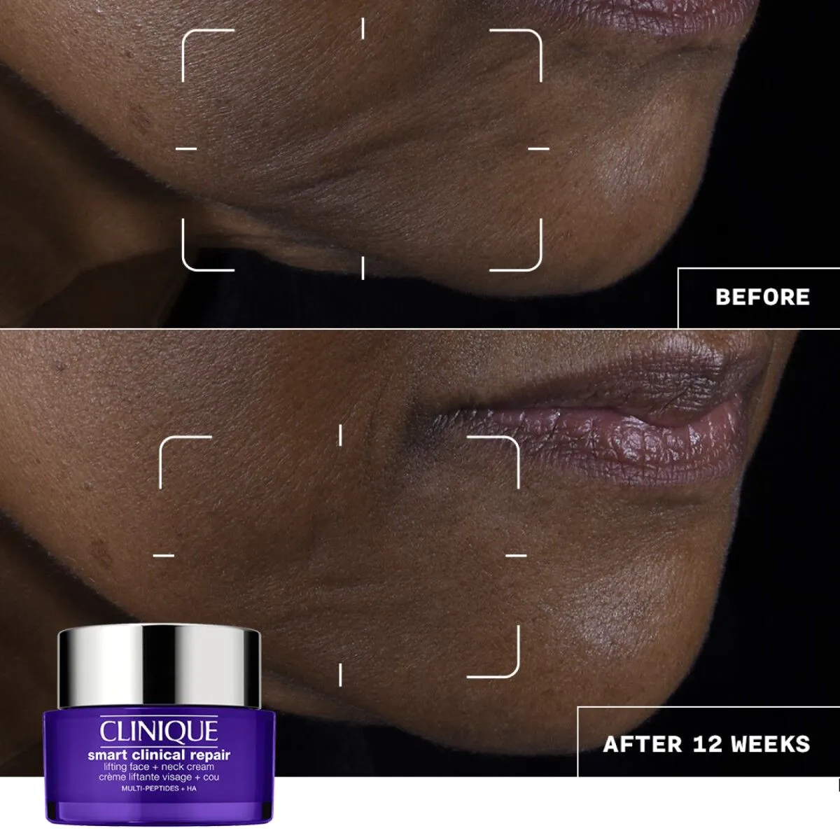 Clinique Smart Clinical Repair Lifting Face + Neck Cream Krem do twarzy i szyi
