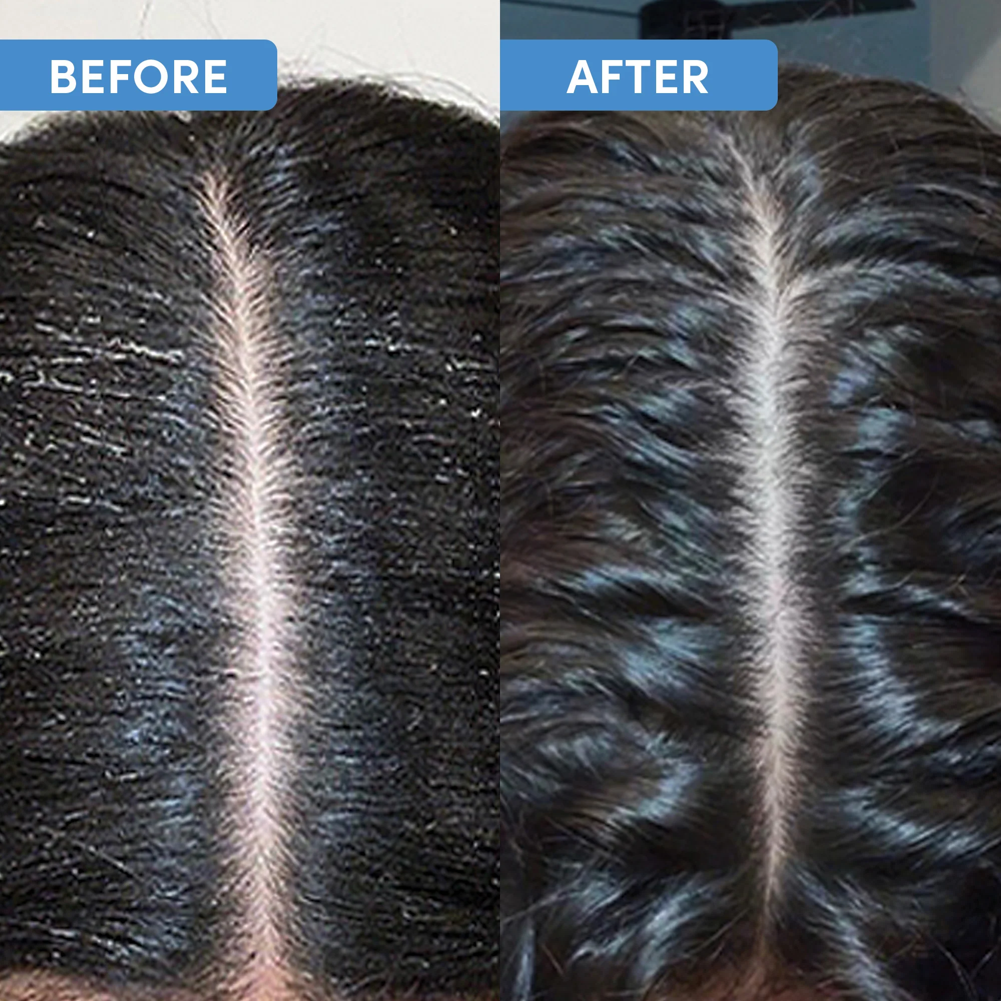 Youth Revive Scalp Renewal Kit - Cofanetti per Capelli