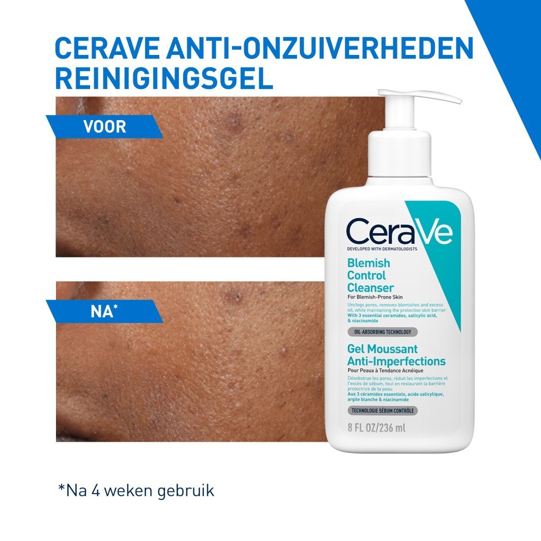 CeraVe gel za čišćenje lica za nepravilnosti – 473 ml