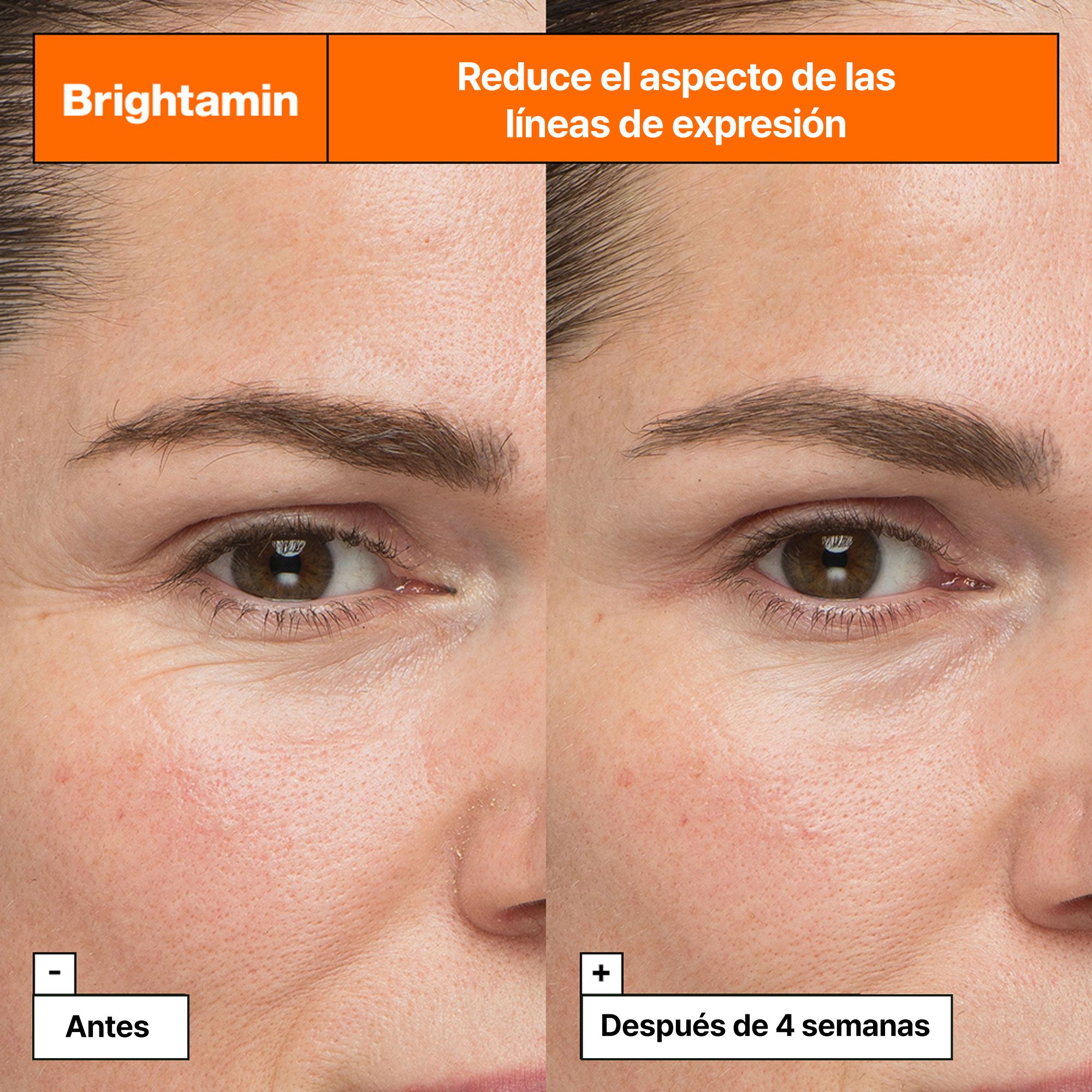 Brightamin ампула за осветљавање Луксузни циљани третмани