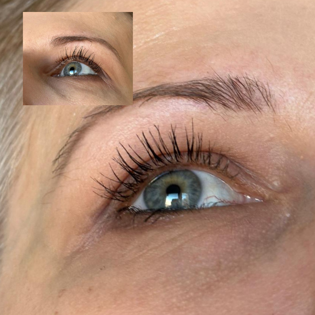 Nachemii serum za trepalnice