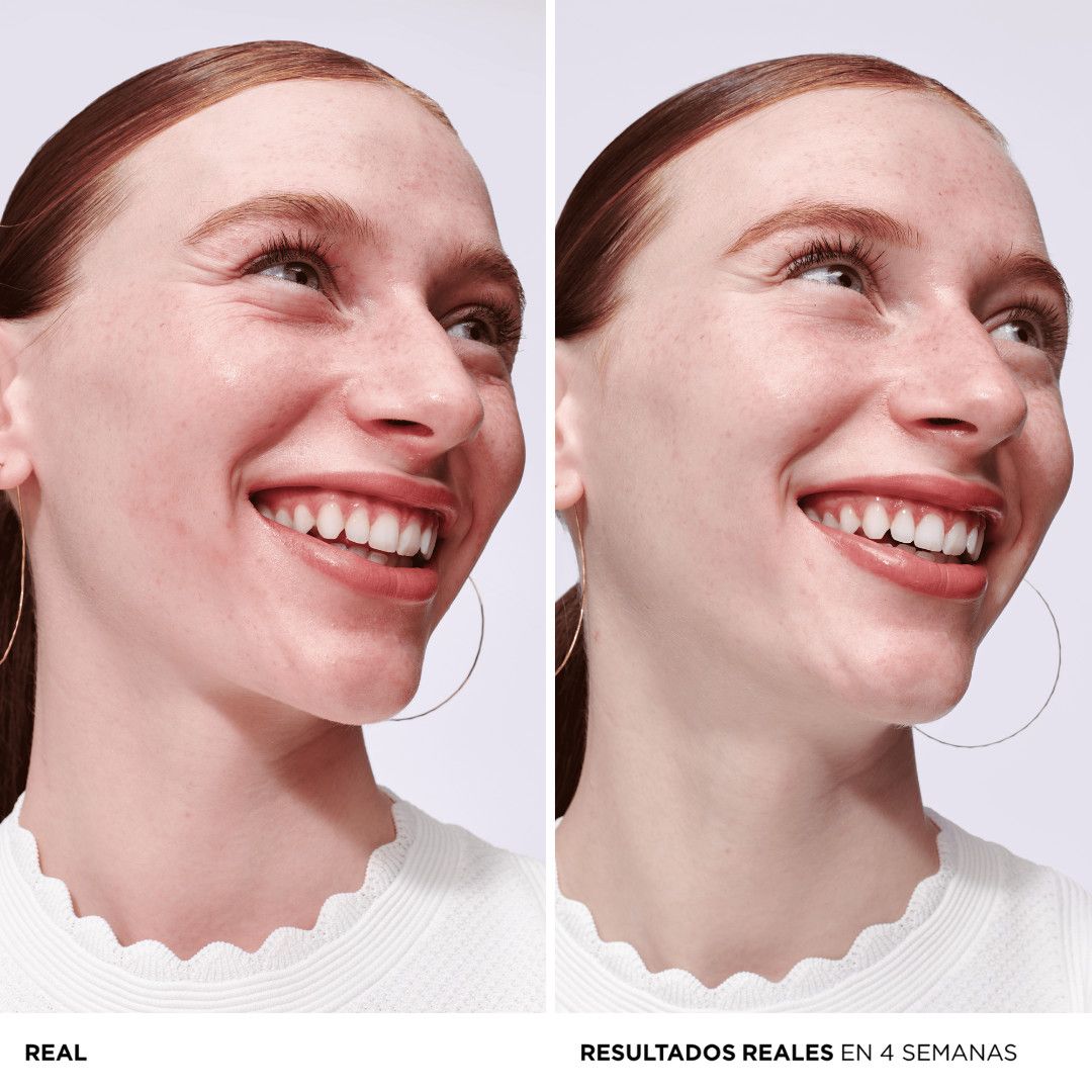 Serum protiv crvenila Bye Bye Redness Umirujući tretmani za osjetljivu kožu