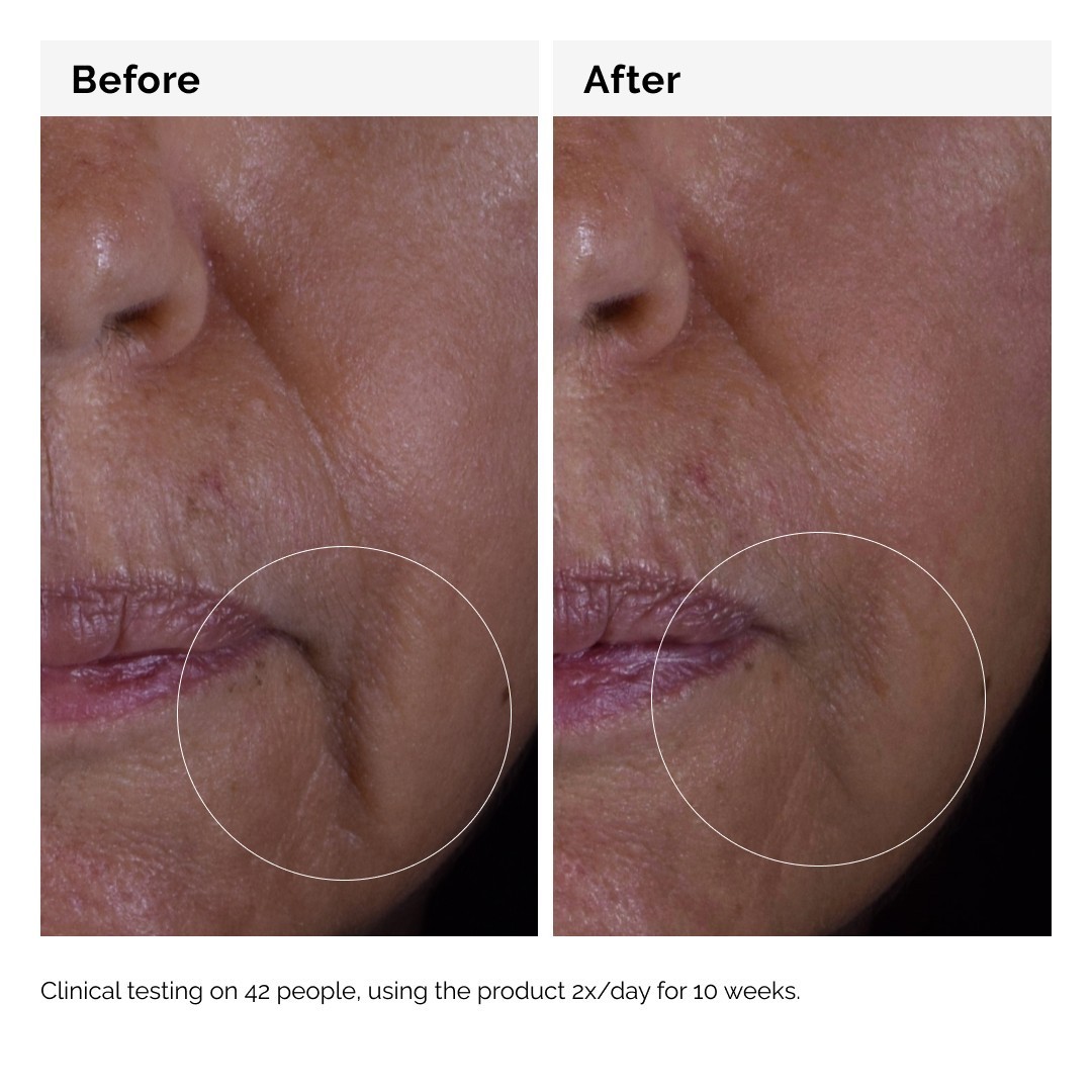 The Ordinary Anti-Aging Serum GF Solution 15% - 30 ml