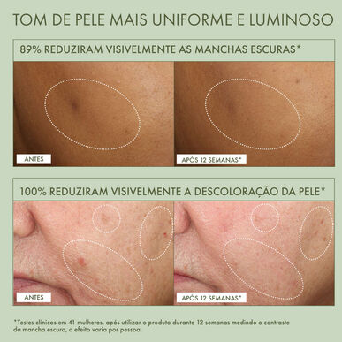 „Origins Mega-Mushroom“ tamsias dėmes koreguojantis serumas 50 ml 50 ml