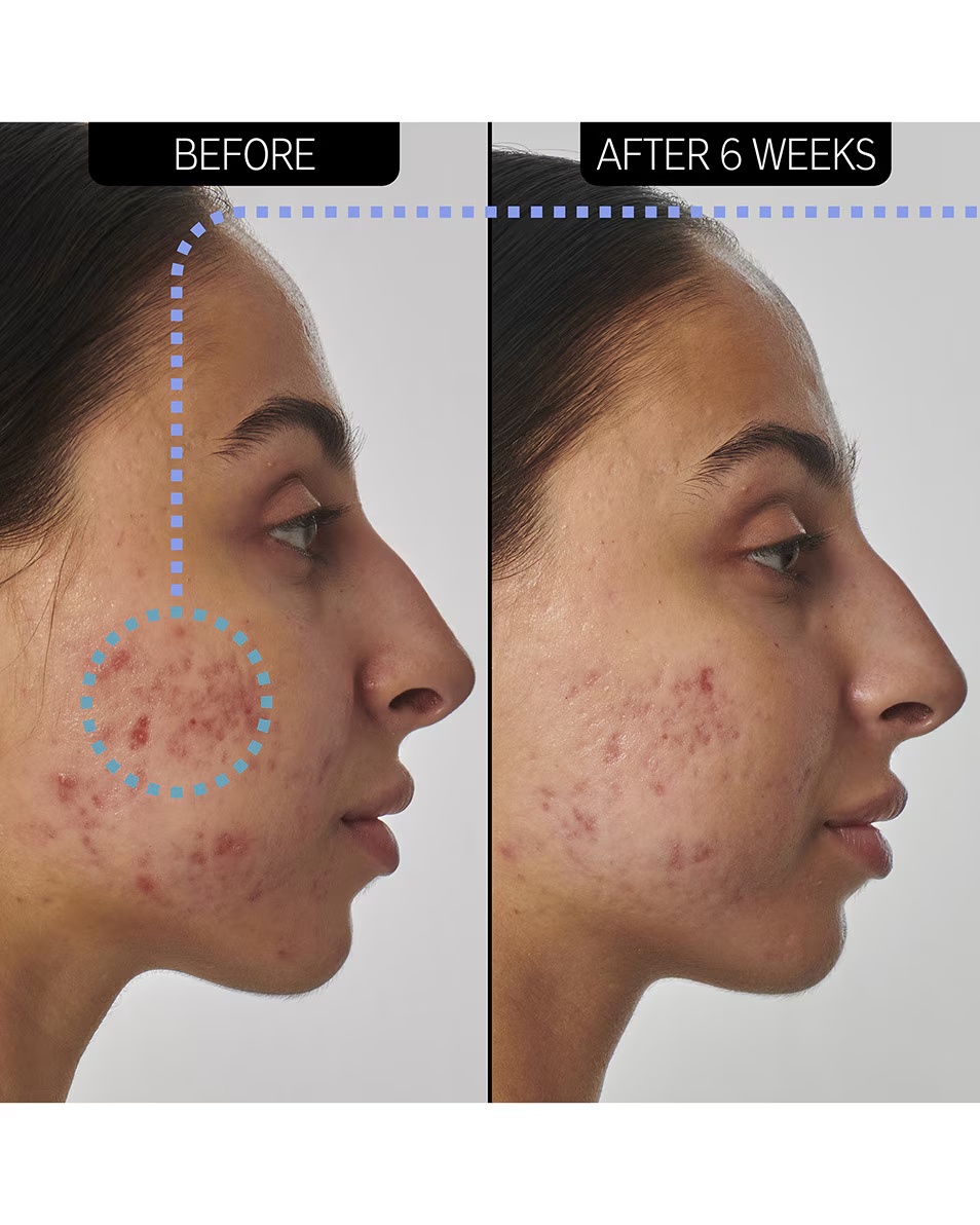 Serul Inkey List SUPERSOLUTIONS cu 1% retinol
