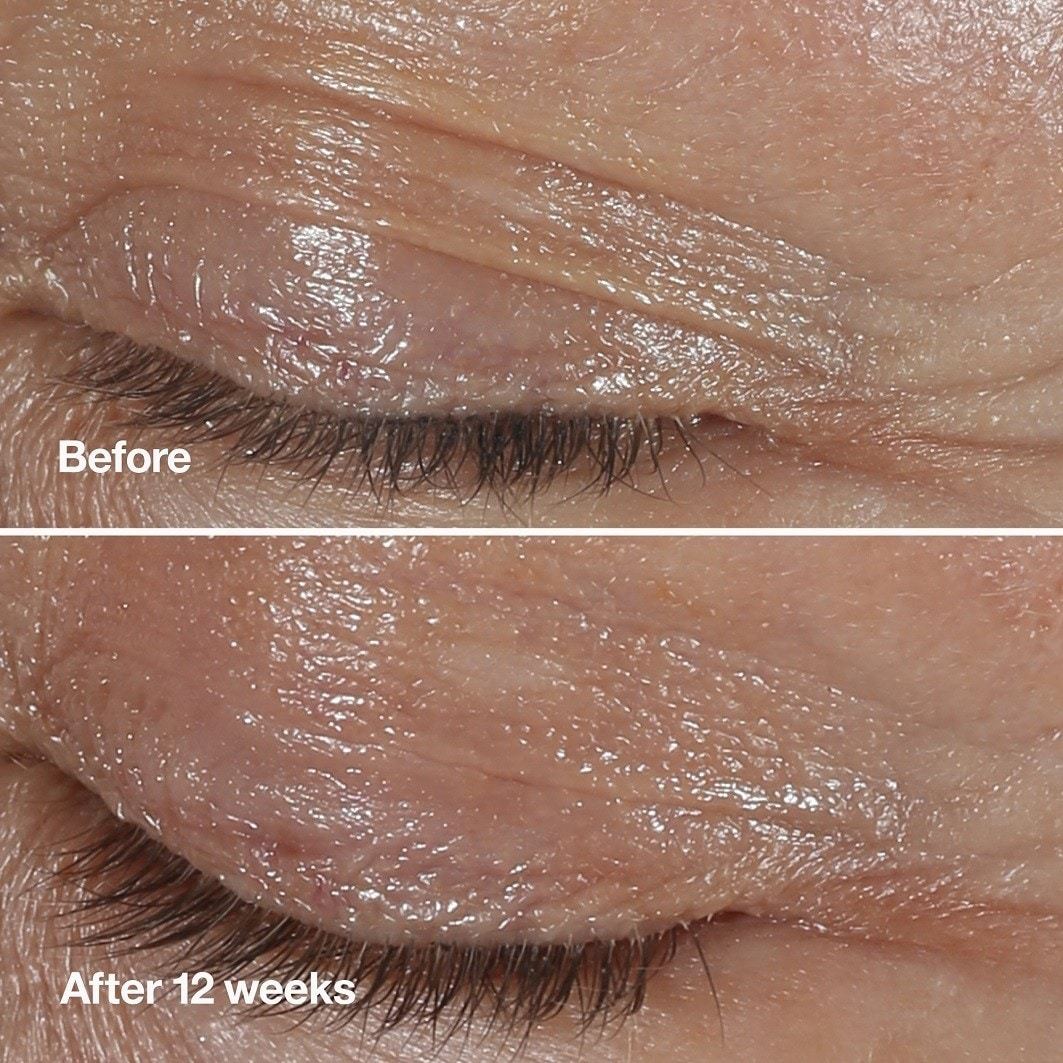 Clinique Smart Clinical Repair krema za korekciju bora oko očiju – 15 ml