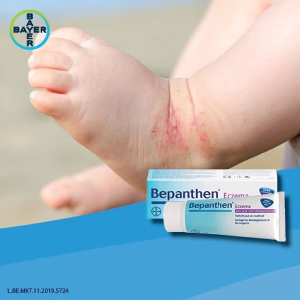Bepanthen Eczema Anti-jeuk kremas<br>20g