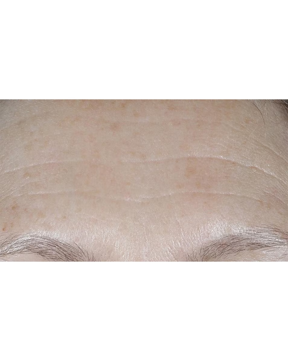 Ενυδατική κρέμα CLINIQUE Smart Clinical Repair™ με SPF - αντιγήρανση