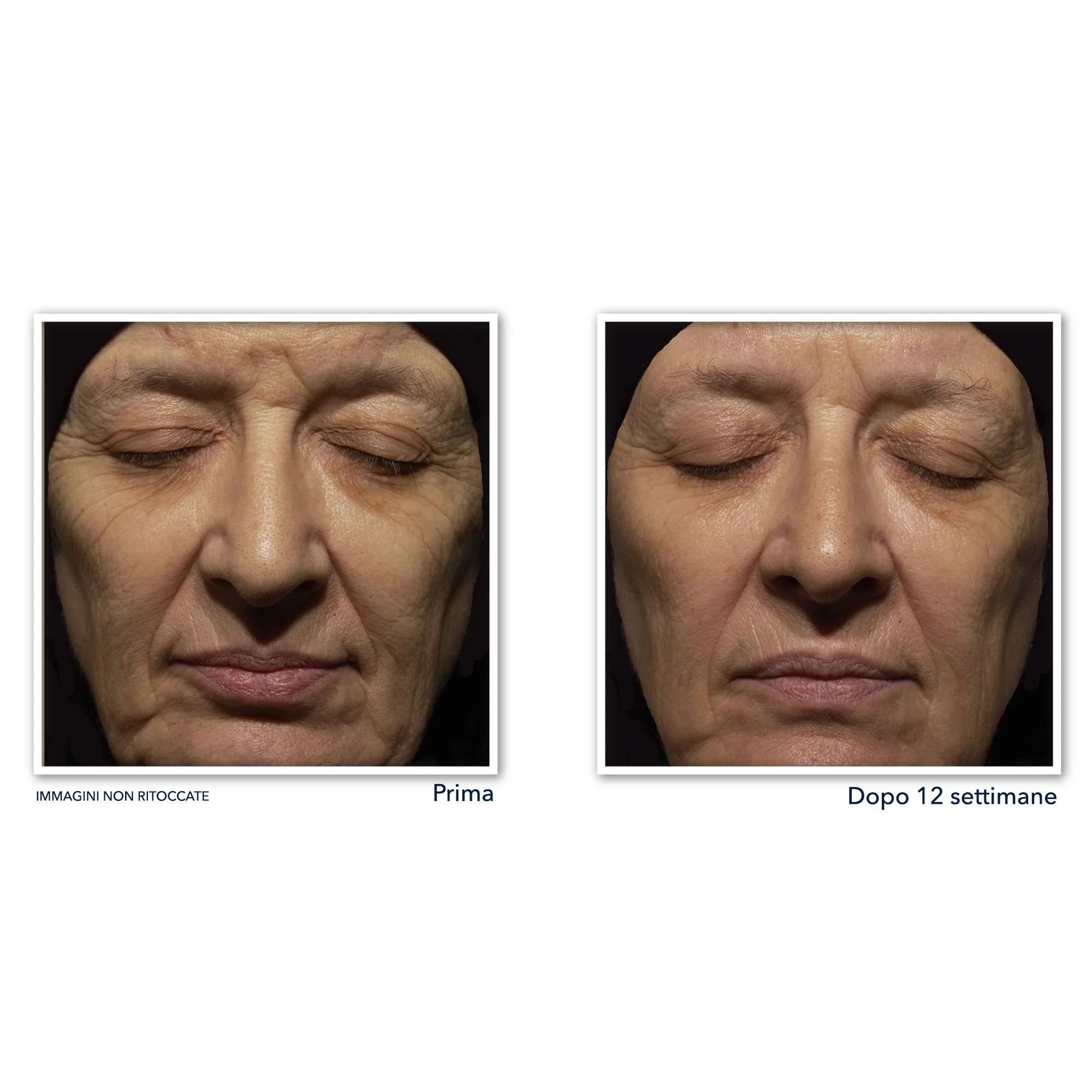 Retinol Correxion Wrinkle Correct Crema Viso Notte - Tratt.viso notte antirughe
