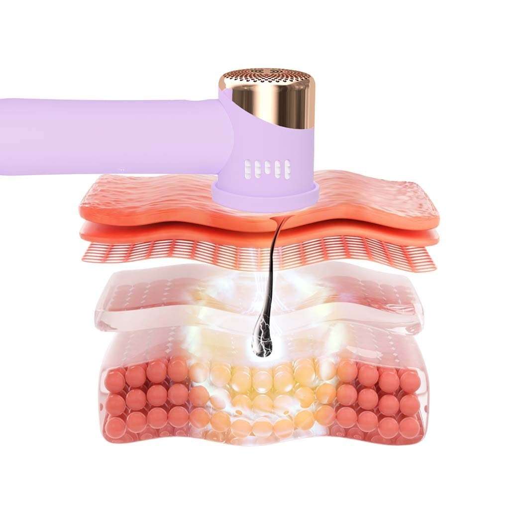 FOREO Epilátor PEACH™ PEACH™ 2 go Peach – Pokročilý, cestovný IPL prístroj na trvalé odstránenie chĺpkov s chladiacim systémom – 1 kus