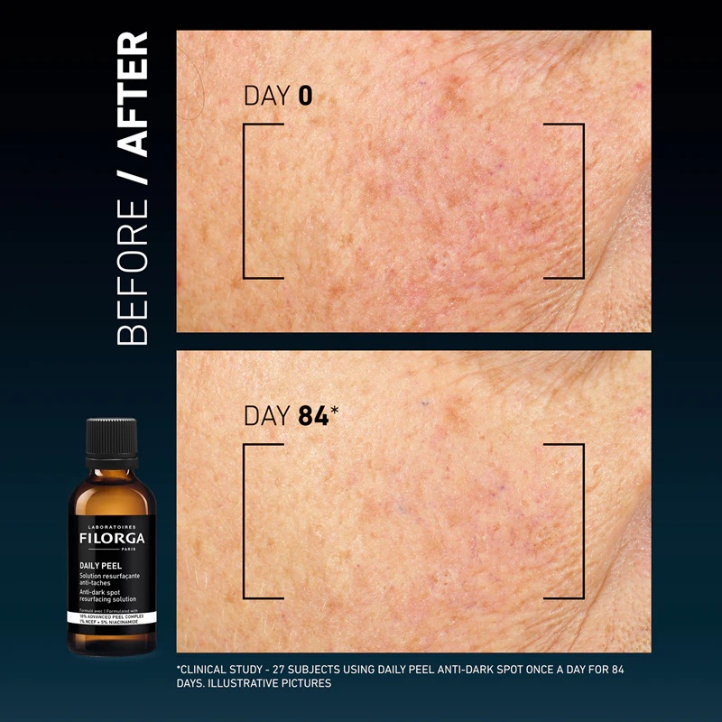 FILORGA DAILY PEEL ANTI-DARK SPOT piling za obraz proti razbarvanju