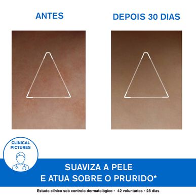 Uriage lipidus papildantis kremas sausai atopinei odai 200 ml