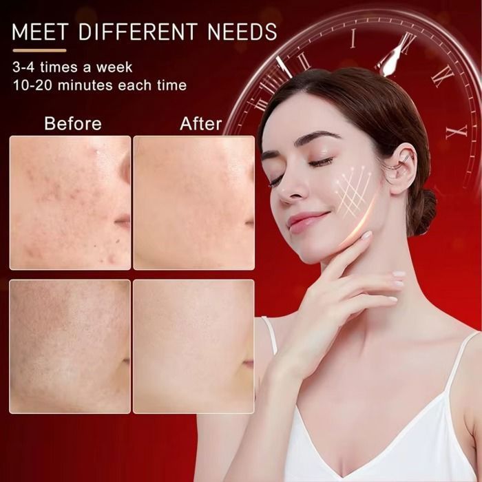 7-Color LED Face Mask – Anti-aging, Acne, and Wrinkle Facial Treatment – 95 Light-Up Beads – Silicone – USB Rechargeable – IPX7