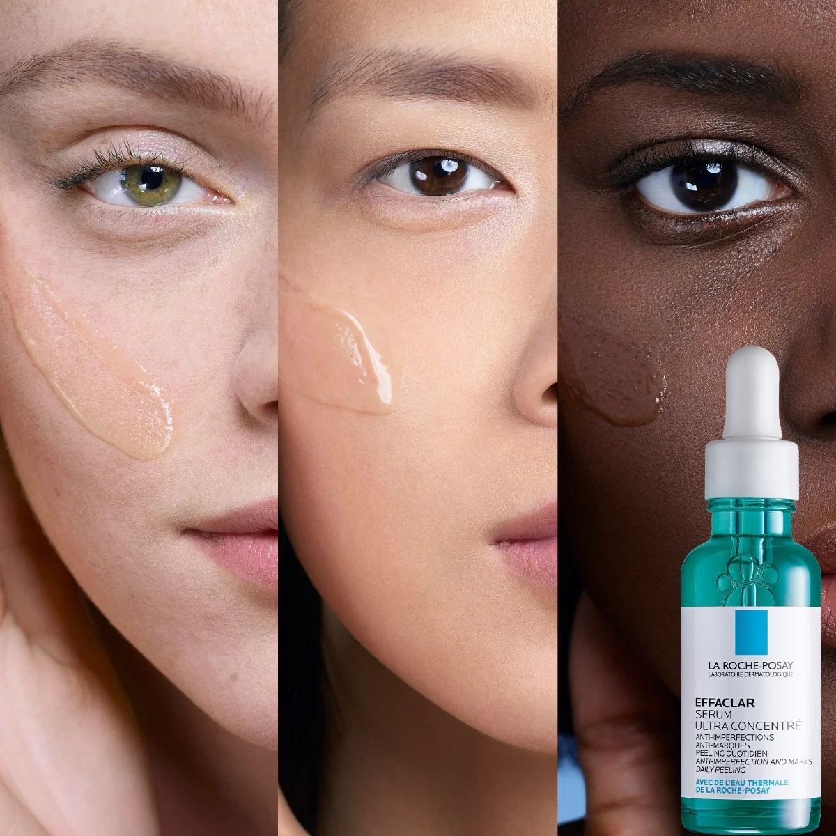 LA ROCHE POSAY La Roche Posay Effaclar Sérum exfoliante ultraconcentrado 30 ml Contra las imperfecciones de la piel Contra las imperfecciones de la piel