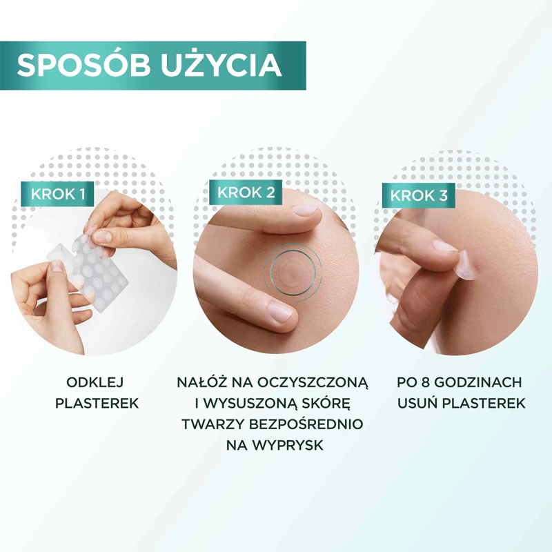 „Garnier Pure Active“ spuogų pleistrai probleminei odai nuo aknės