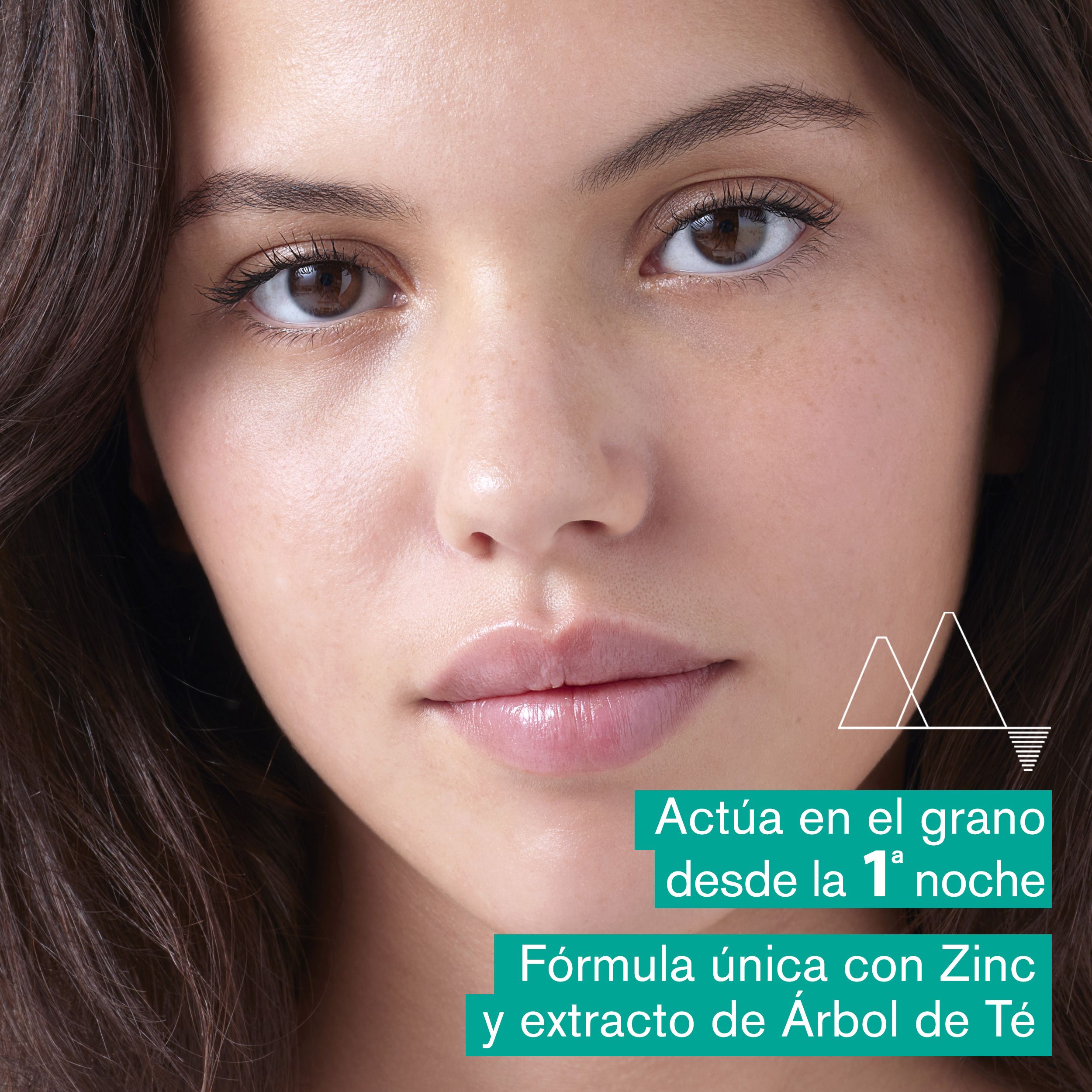 Hyséac SOS Localized Treatment Paste Dermokozmetika za obraz