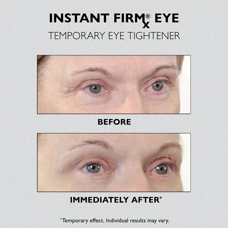 Peter Thomas Roth Instant FIRMx paakių atjauninamasis paakių kremas