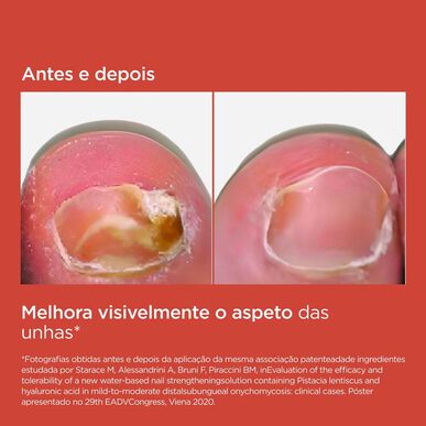 Isdin Si-Nails MicoXpert MD Neglesoppbehandling 4,5 ml 4,5 ml