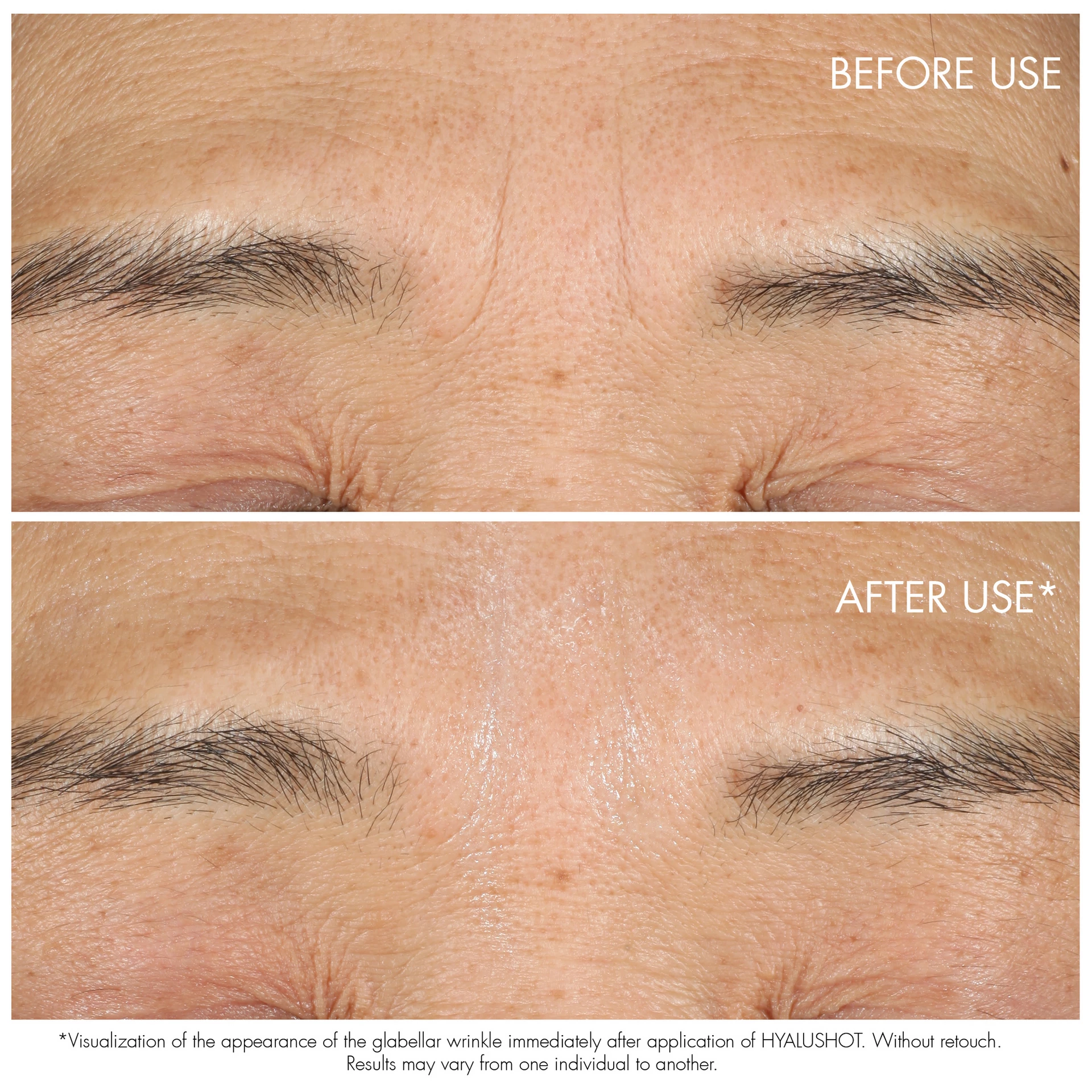 Capture Totale Retishot Serum 20 ml - DIOR